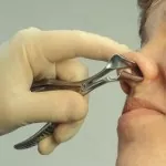 Vienna Nasal Speculum